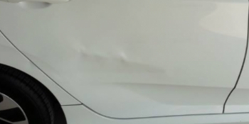 Boyasız Göçük Düzeltme